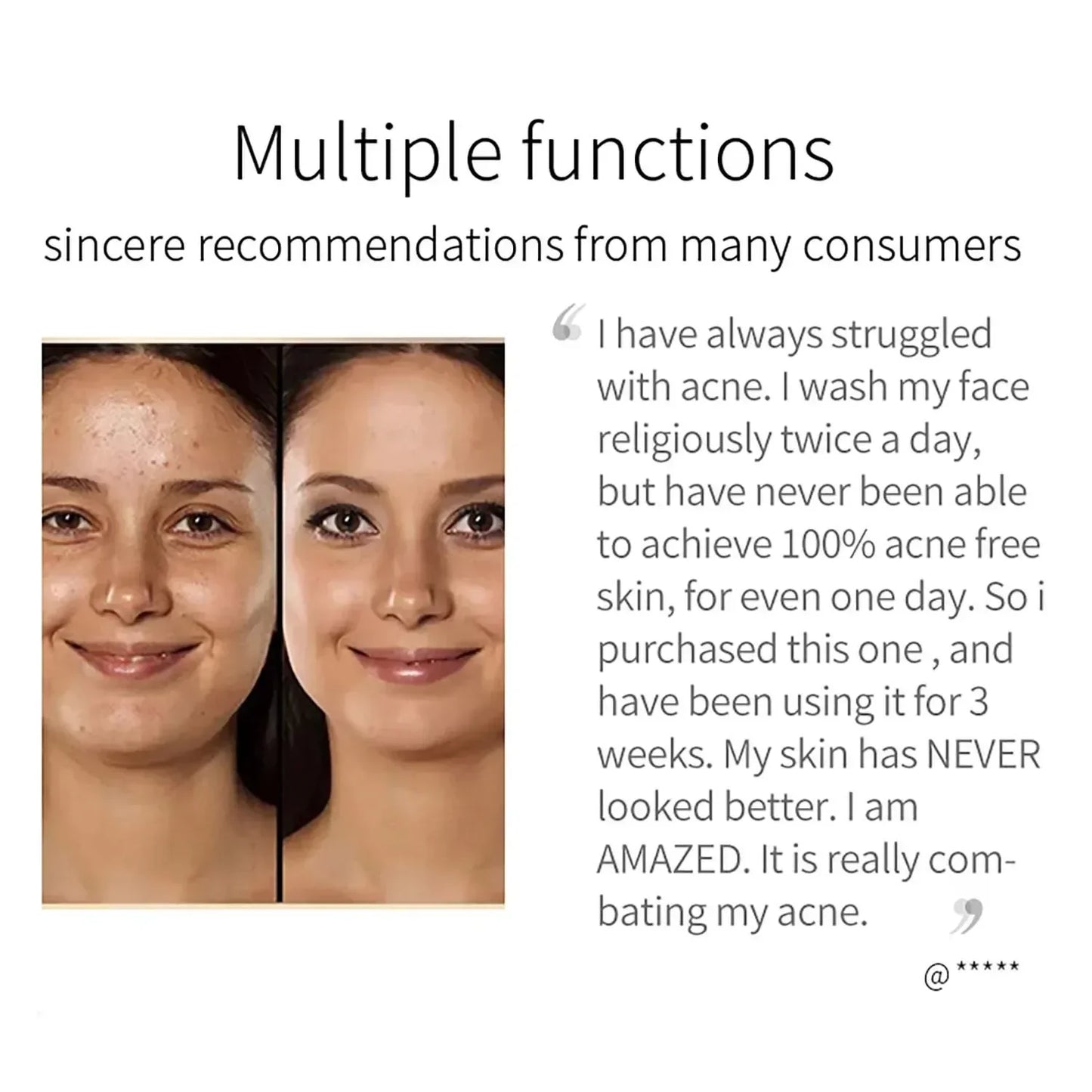 Turmeric Glow Soap – Fades Dark Spots & Evens Skin Tone